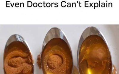 Cinnamon and Honey: Nature’s Mysterious Healing Duo That Baffles Science