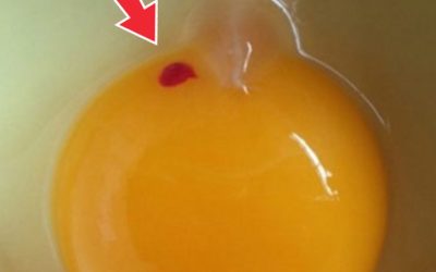 Should We Eat Eggs With BL00D Spots?