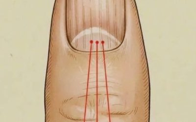 What to Eat to Reduce Nail Ridges: A Nutrition Guide for Healthier Nails