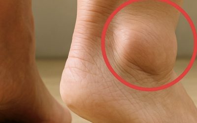 If your feet swell, it is a clear sign that…