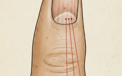 If you have these lines on your nails, you should pay attention.