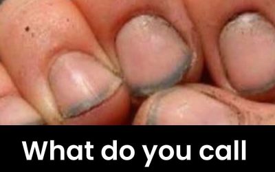 What do you call a person with nails like that? I was very surprised……………see more👇