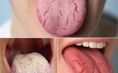 These are the consequences of sleeping with the… See more
