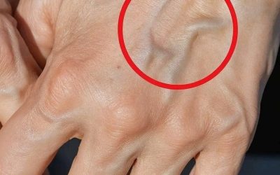 Visible Veins What They Mean and Why You Might See Them