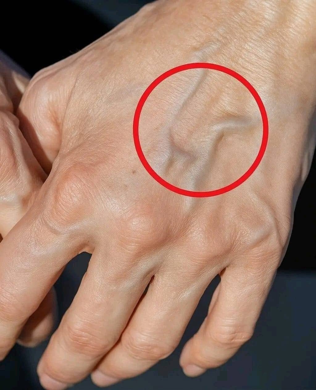 Visible Veins What They Mean and Why You Might See Them