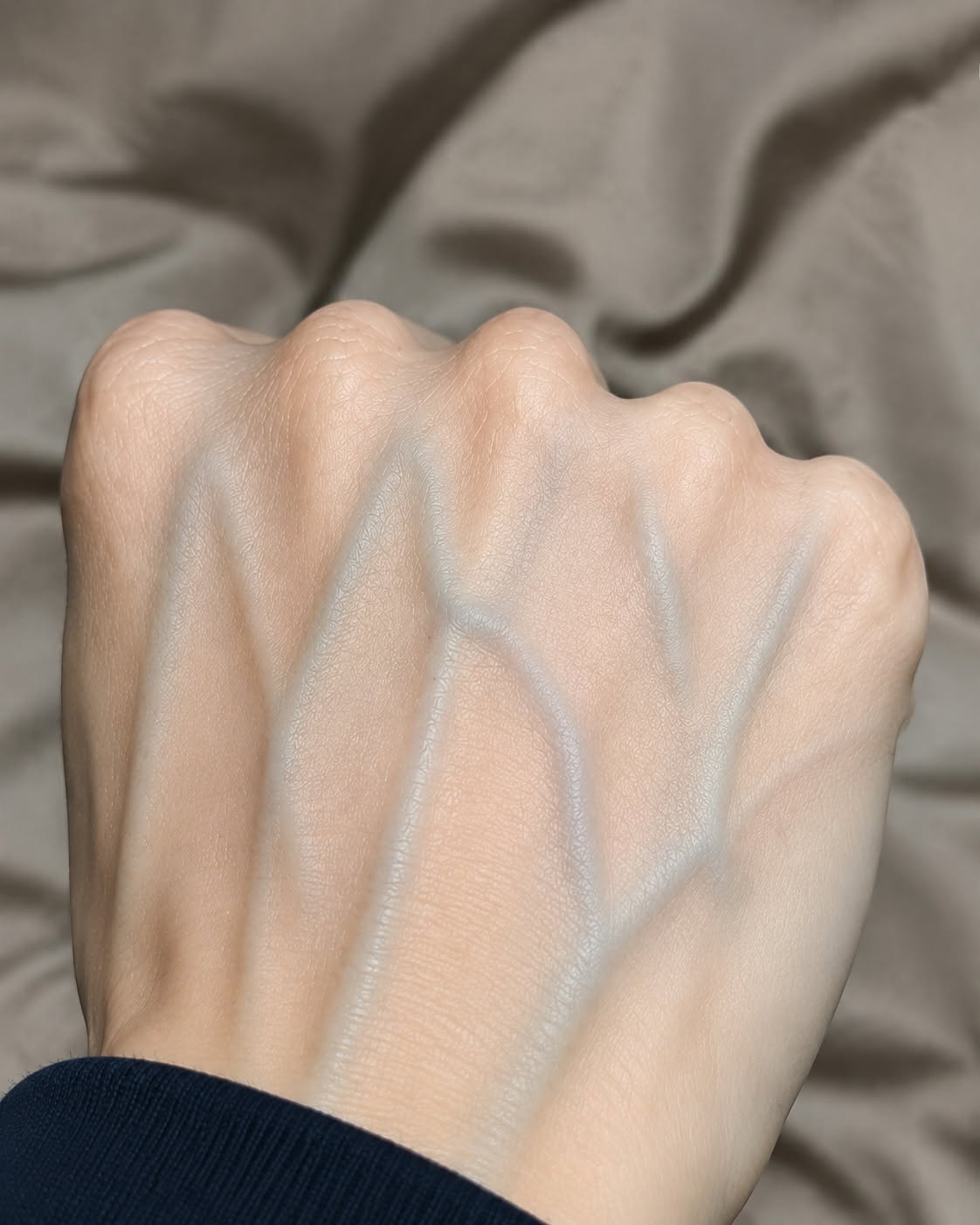 If your veins are visible, here’s what it means