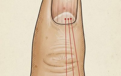 If you have these lines on your nails, you should pay attention.