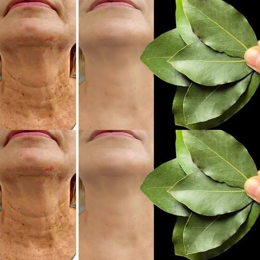 Bay Leaf Is 100,000 Times Stronger Than Botox? | Natural Wrinkle Eraser Even at Age 70!
