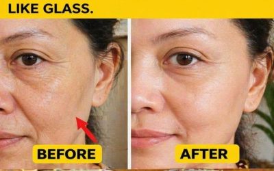 Prepare the baking soda cream and apply it before bed. Goodbye wrinkles and blemishes… To continue receiving my recipes, you just need to