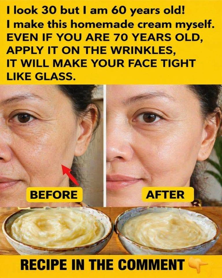 Prepare the baking soda cream and apply it before bed. Goodbye wrinkles and blemishes… To continue receiving my recipes, you just need to