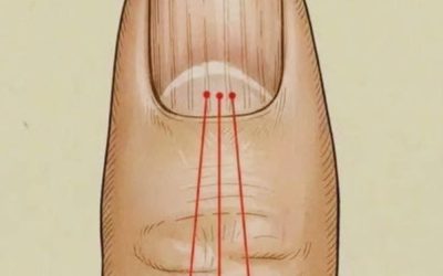 What to Eat to Reduce Nail Ridges: A Nutrition Guide for Healthier Nails