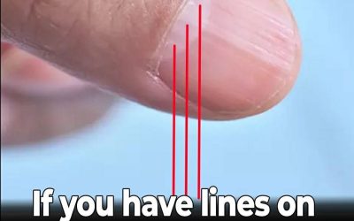 Doctor Uncovers A Telltale Sign In Your Fingernails That May Predict Your Life Expectancy