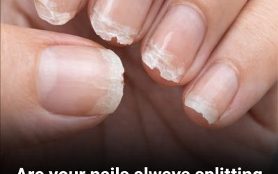 Weak or Brittle Nails: What Your Body Is Trying to Tell You