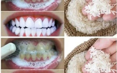 Whiten your teeth in just 1 minute with this simple home trick.