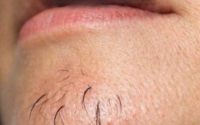 A woman’s chin hair is a sign of… See more