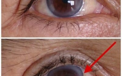 These are the first symptoms of a… See more