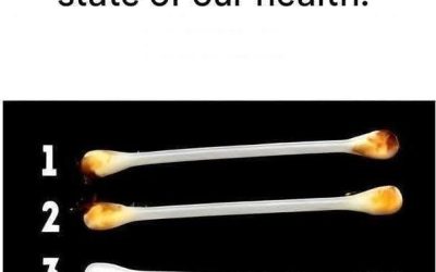Our ears reveal the true state of our health