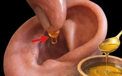 Naturalne sposoby na bóle uszu i infekcje ucha: bezpieczne rozwiązania na załatwianie się w domu