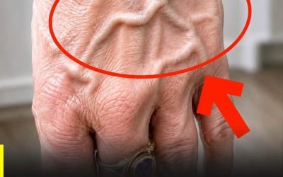 Did you know that having visible veins means you are