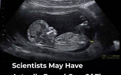Scientists Explore a Potential Link Between Maternal Gut Health and Autism—But Here’s What We Actually Know