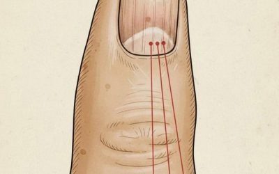 If you have these lines on your nails, you should pay attention.