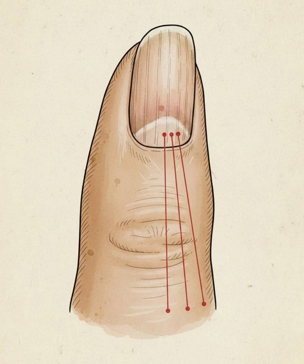 If you have these lines on your nails, you should pay attention.