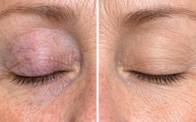 These are the first symptoms of a… See more