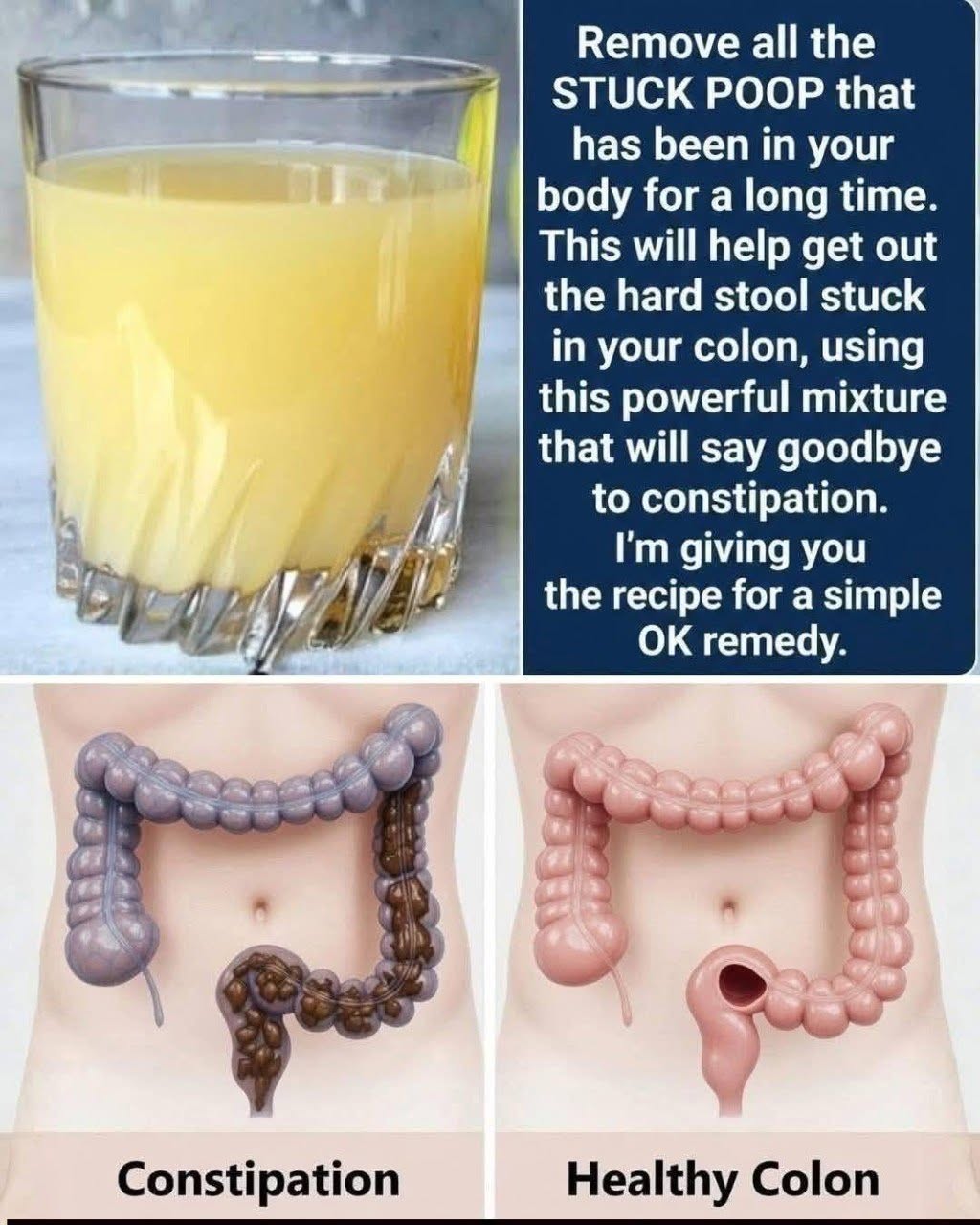 Get rid of all the stuck poop you’ve had in your body for a long time. This will even get rid of the gum you ate in kindergarten. With this powerful mixture, you’ll say goodbye to constipation. I’ll give you the recipe for a simple “OK”.