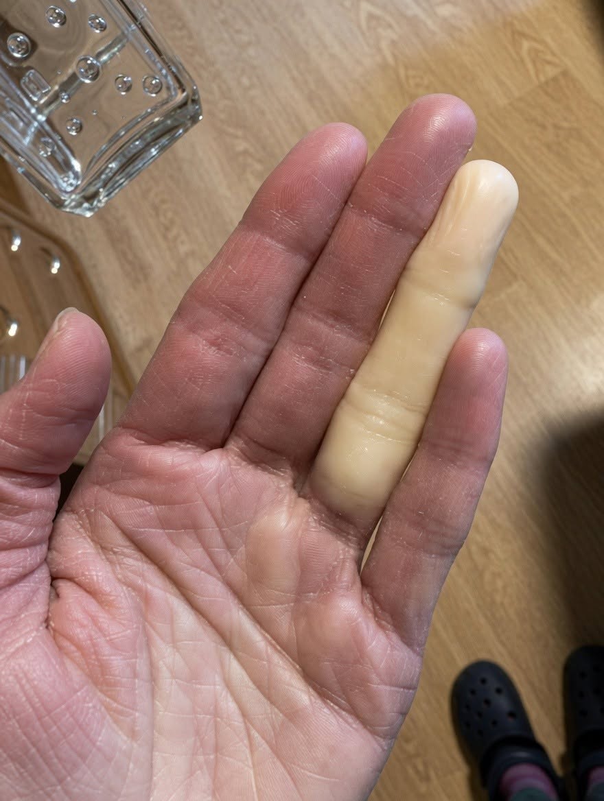 Ever woke up with a completely pale, numb finger?