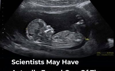 Scientists Explore a Potential Link Between Maternal Gut Health and Autism—But Here’s What We Actually Know