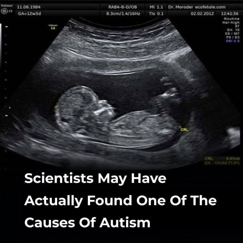 Scientists Explore a Potential Link Between Maternal Gut Health and Autism—But Here’s What We Actually Know