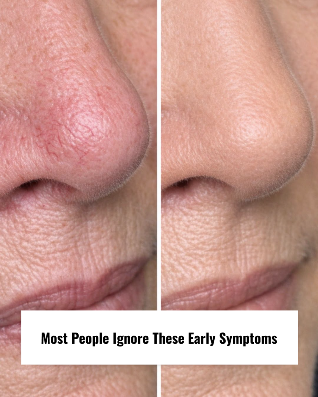 Most People Ignore These Early Symptoms