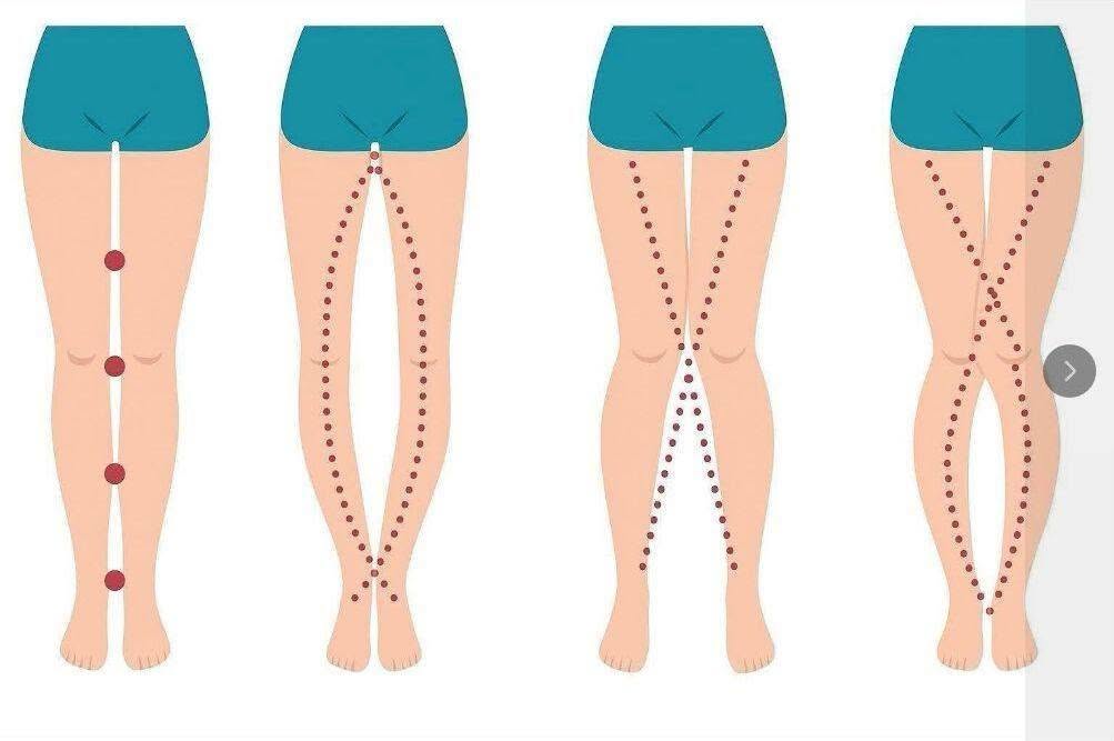 A WOMAN’S LEGS CAN TELL HOW HER IS…See More