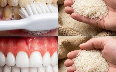 A radiant smile in sixty seconds: the little-known rice-based method