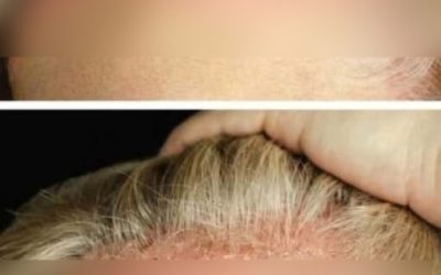 These are the consequences of bathing with… See more