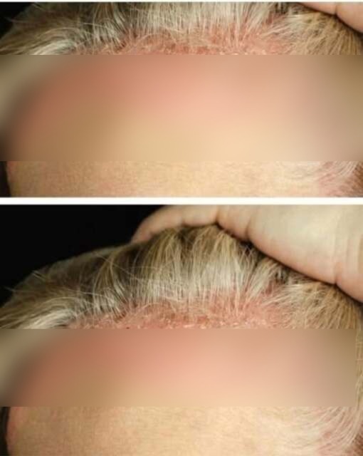 These are the consequences of bathing with… See more